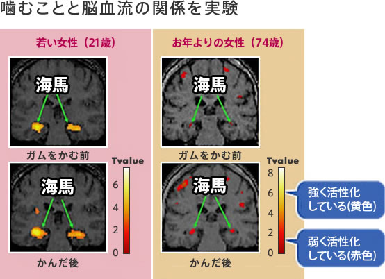 正しい噛み合わせでしっかりと噛む｜デンタルアンチエイジング｜中垣