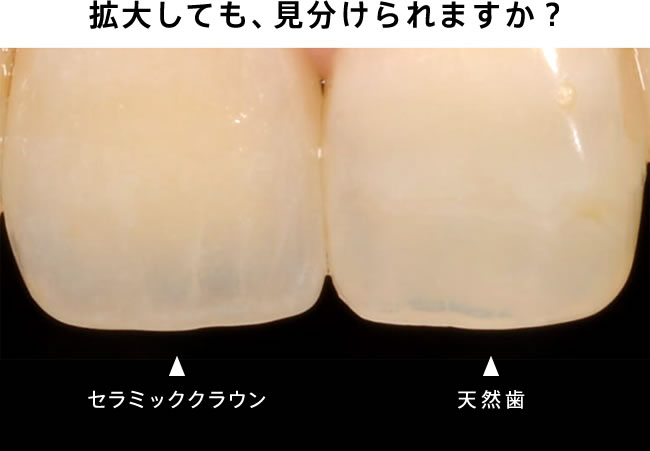 拡大しても、見分けられますか？