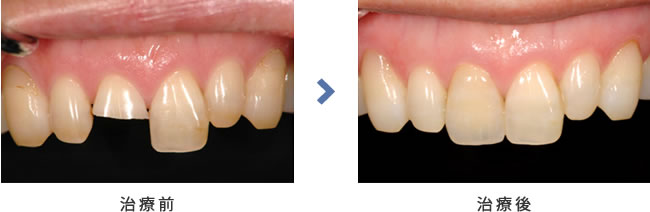 治療前後の比較