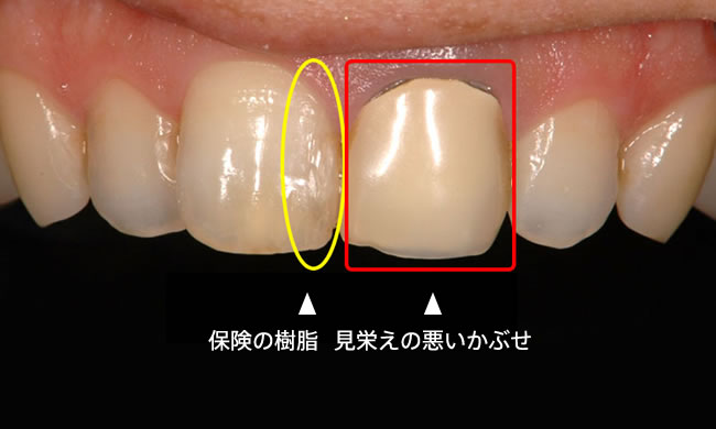 初診時正面写真