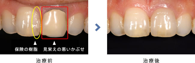 治療前後の比較